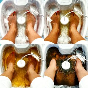 Aqua Detox -terapia 45 min