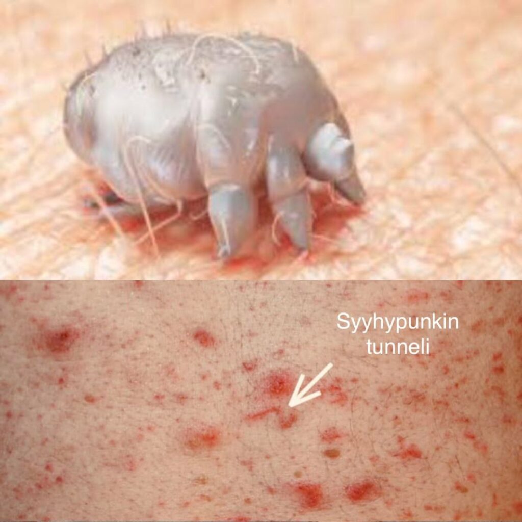 Syyhyn saa pyytämättäkin