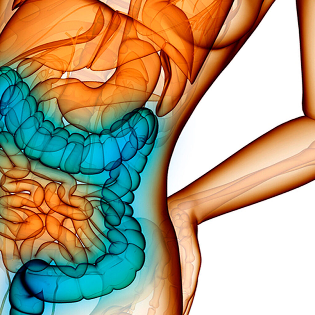 Colonic-terapia UKK, eli kaikki mitä halusit tietää suolihuuhtelusta osa 4.