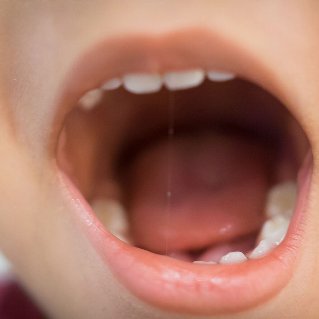 AFTAT – nuo kipeät nastat